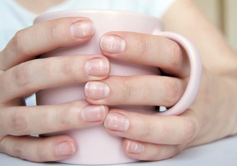 Białe plamki na paznokciach – czy to powód do niepokoju?