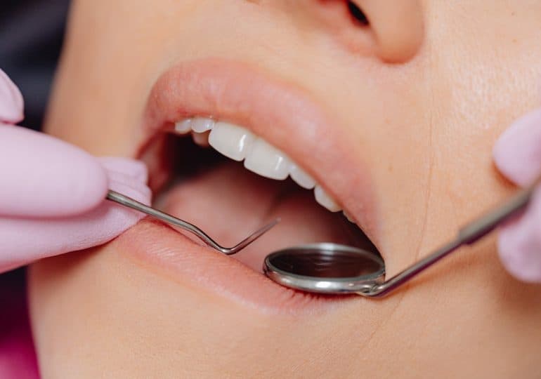 Zalety implantów zębowych