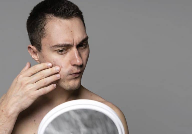 Swędzenie skóry na tle nerwowym — jak sobie z nim radzić?